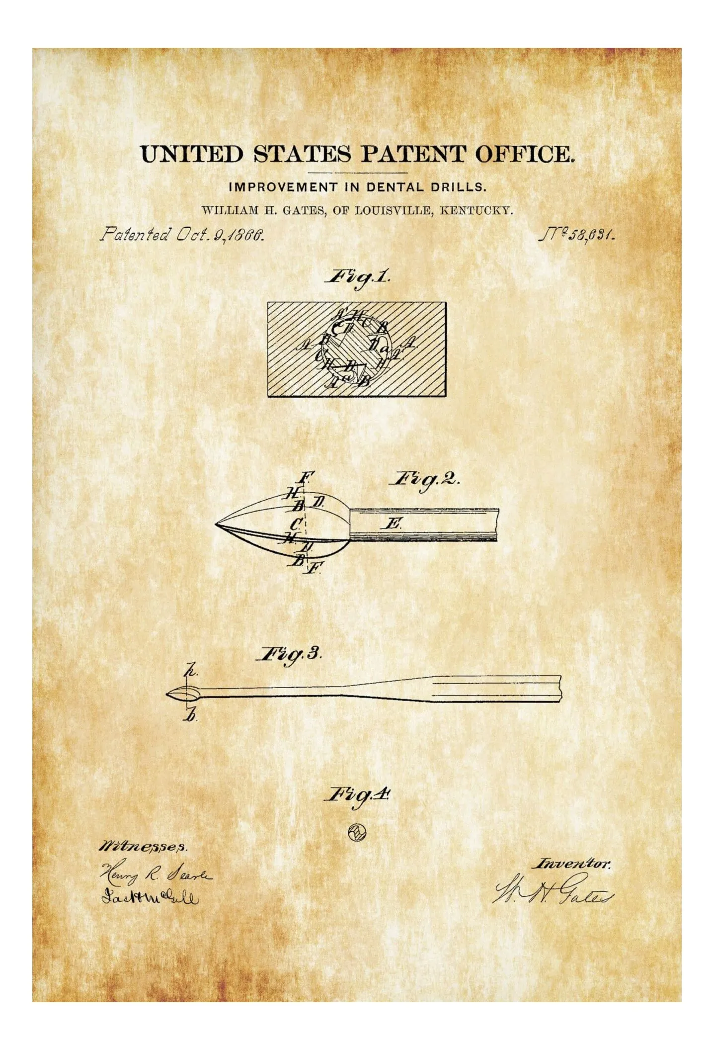 Dental Drill Patent Print 1886 - Dental Office Decor, Dental Hygienist Gift, Dental Art, Dentist Decor, Dental Tools, Dental Assistant Gift