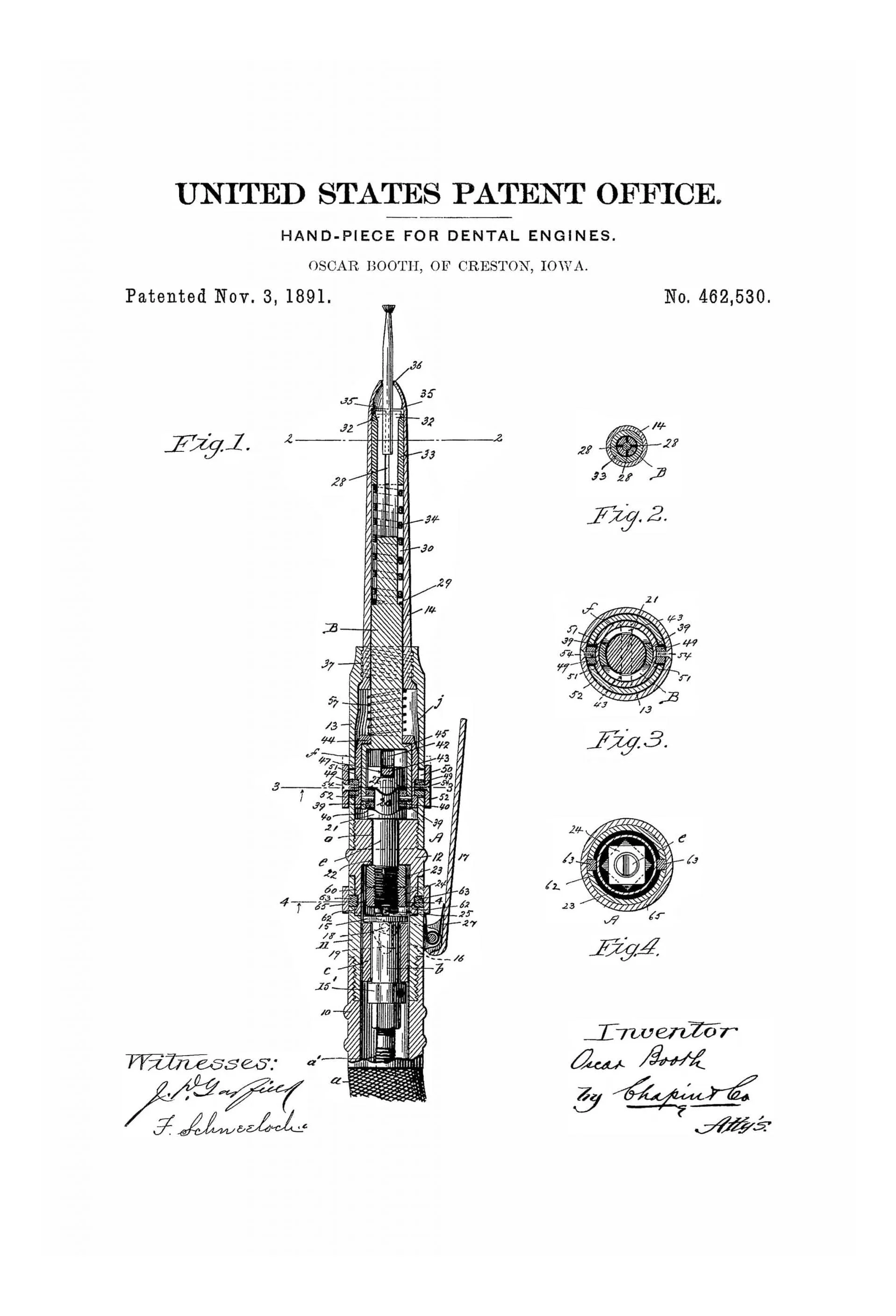 Dental Engine Patent Print - Dental Office Decor, Medical Art, Dental Art, Dentist Decor, Dental Tools, Dental Patent, Dental Handpiece