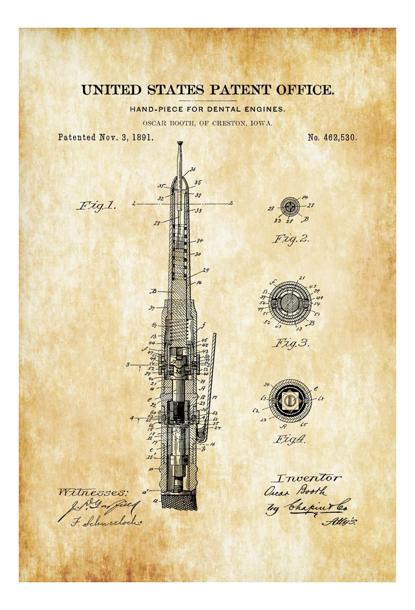 Dental Engine Patent Print - Dental Office Decor, Medical Art, Dental Art, Dentist Decor, Dental Tools, Dental Patent, Dental Handpiece