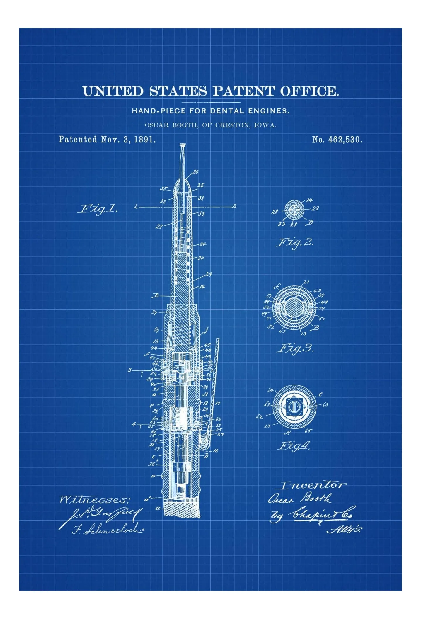 Dental Engine Patent Print - Dental Office Decor, Medical Art, Dental Art, Dentist Decor, Dental Tools, Dental Patent, Dental Handpiece